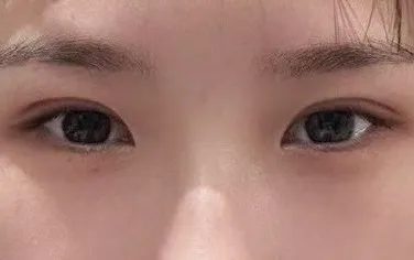 術後