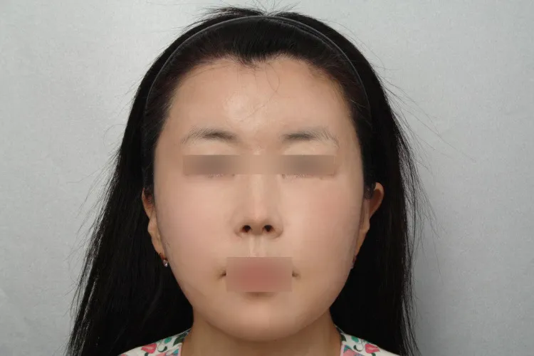 術後