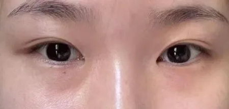 術前